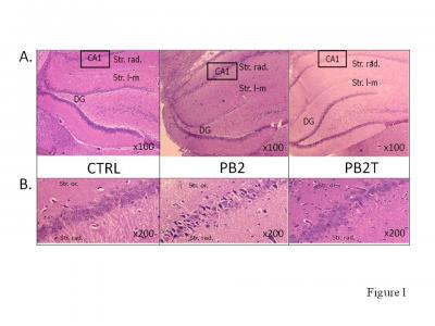 Figure 1: A) Photomicrograph of hippocampus CA1 stained with H&E (x100). B) Photomicrograph in higher magnification (x200). PB2 shows shrunken apoptotic neurons (darkly stained). PB2T shows reduced number of atypically morphology cells compared to PB2, but disorganized arrangement of cells compared to CTRL. Str. or.: stratum oriens, Str. rad.: stratum radiatum, Str. l-m: stratum lacunosum molecular, DG: dentate gyrus.