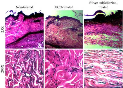 Figure 1: Skin tissue at day 7 following wound creation (Verhoeff eosin staining).