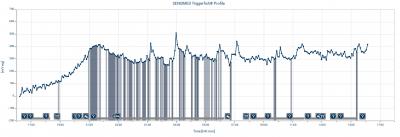 Figure 1: A 24-hour IOP profile measured by the contact lens sensor. Activities of the patient are noted at the bottom of the graph and the grey shades in the profile shows sleeping period of the patient (Source: Sample monitoring done in our clinic for investigation purpose) 