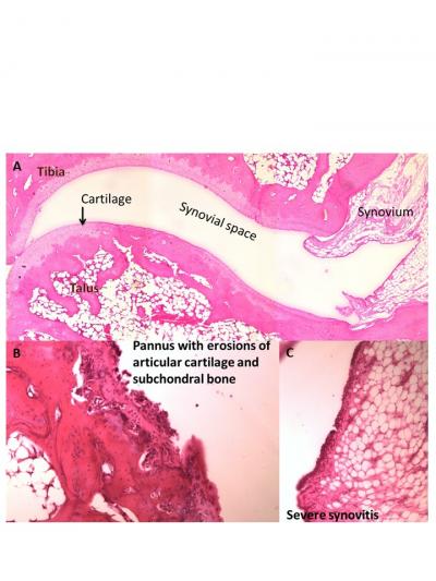 Figure 1: Representative histological features of a normal synovial joint (A), and the arthritic changes in the synovial joints (B and C).