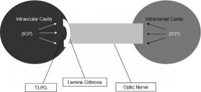 Figure  1:  Diagram  shows  the  relationship  of  pressures  affecting  optic  nerve;  intraocular  pressure  (IOP), intracranial  pressure  (ICP), and translaminar pressure  difference  (TPD) (Hou et al. 2016).