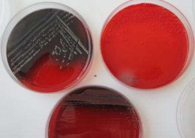 Figure 1: Growth of S. mutans strains on CRA plates