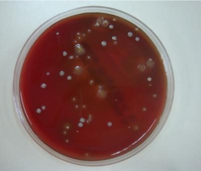 Figure 1: Aerobic bacteria’s colonies on TSBA exhibited different colony characteristics; circular, creamy white colonies, irregular glistening brown colonies or circular tiny white colonies with a colourless ring