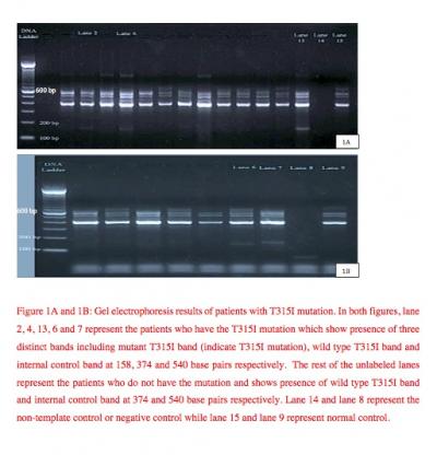 Figure 1A and 1B: Gel electrophoresis results of patients with T315I mutation. In both figures, lane 2,4, 13, 6 and 7 represent the patients who have the T315I mutation which show presence of three disinct bands including mutant T315I band (indicate T315I mutation), wild type T315I band and internal control band at 158, 374 and 540 base pairs respecticely. The rest of the unlabeled lanes represent the patients who do not have the mutation and shows presence of wild type T315I band and internal c